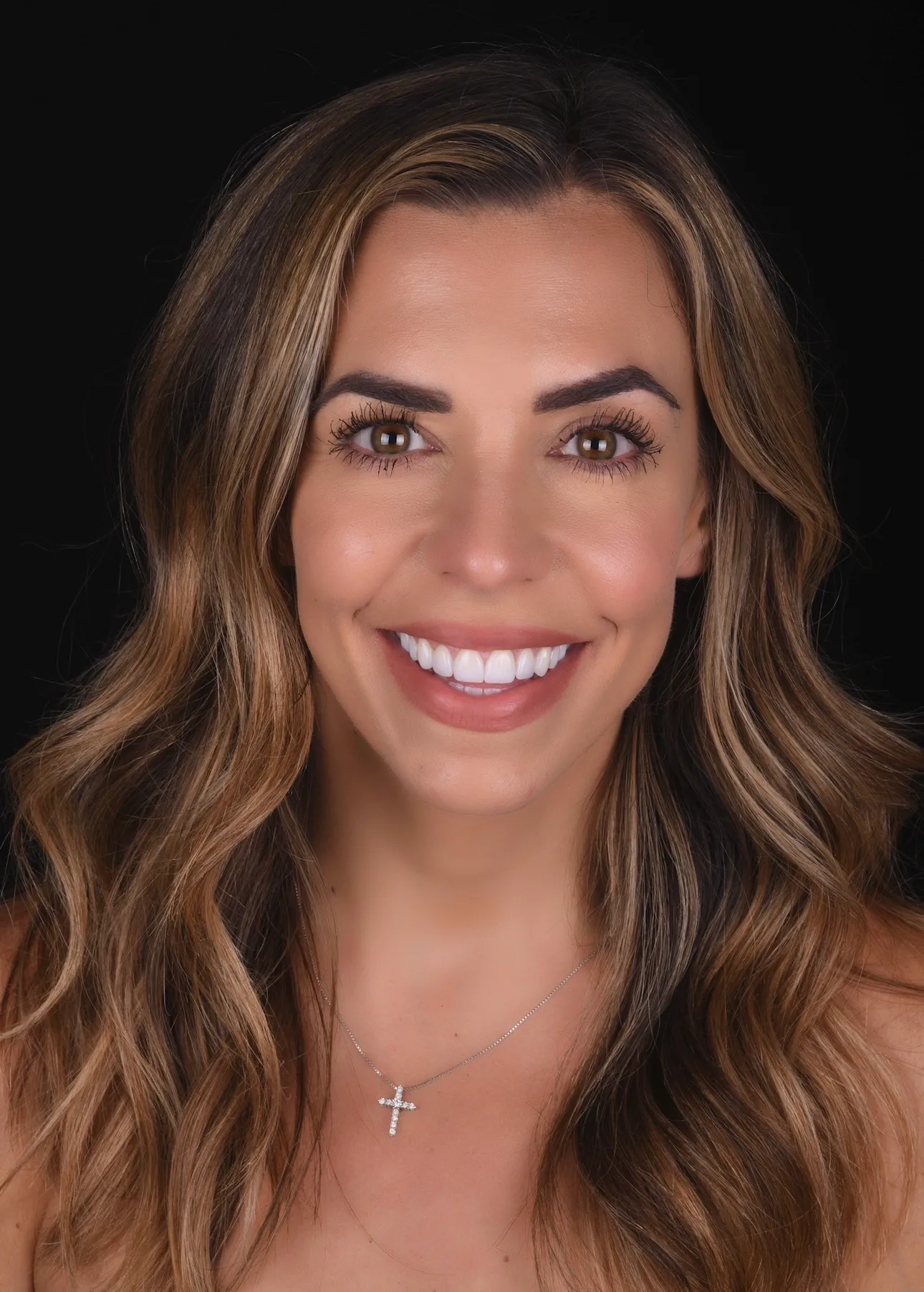 Full face after photo for porcelain veneers case in Fort Myers