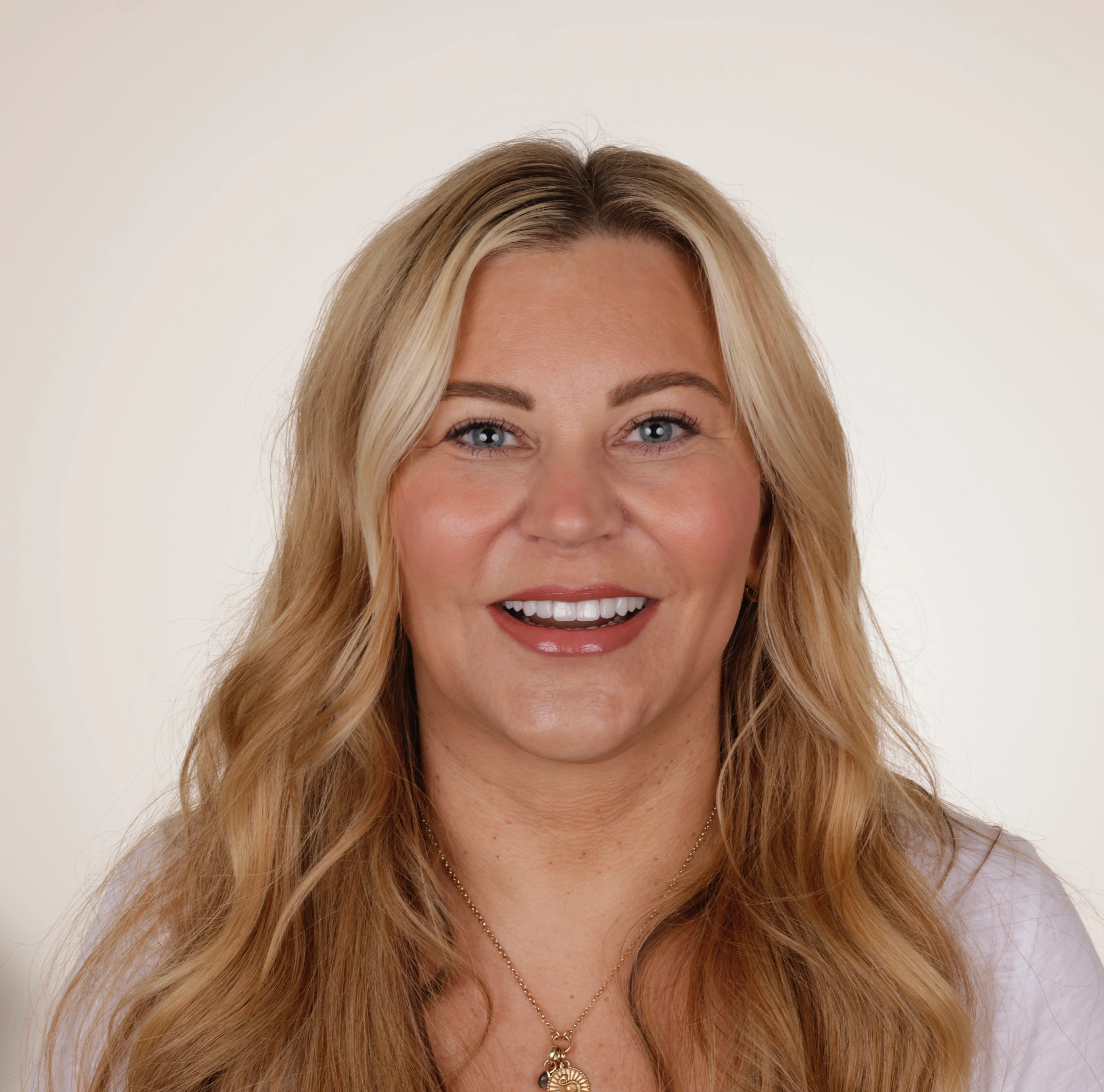 Full face after photo for veneer smile makeover by Dr Jared Ford