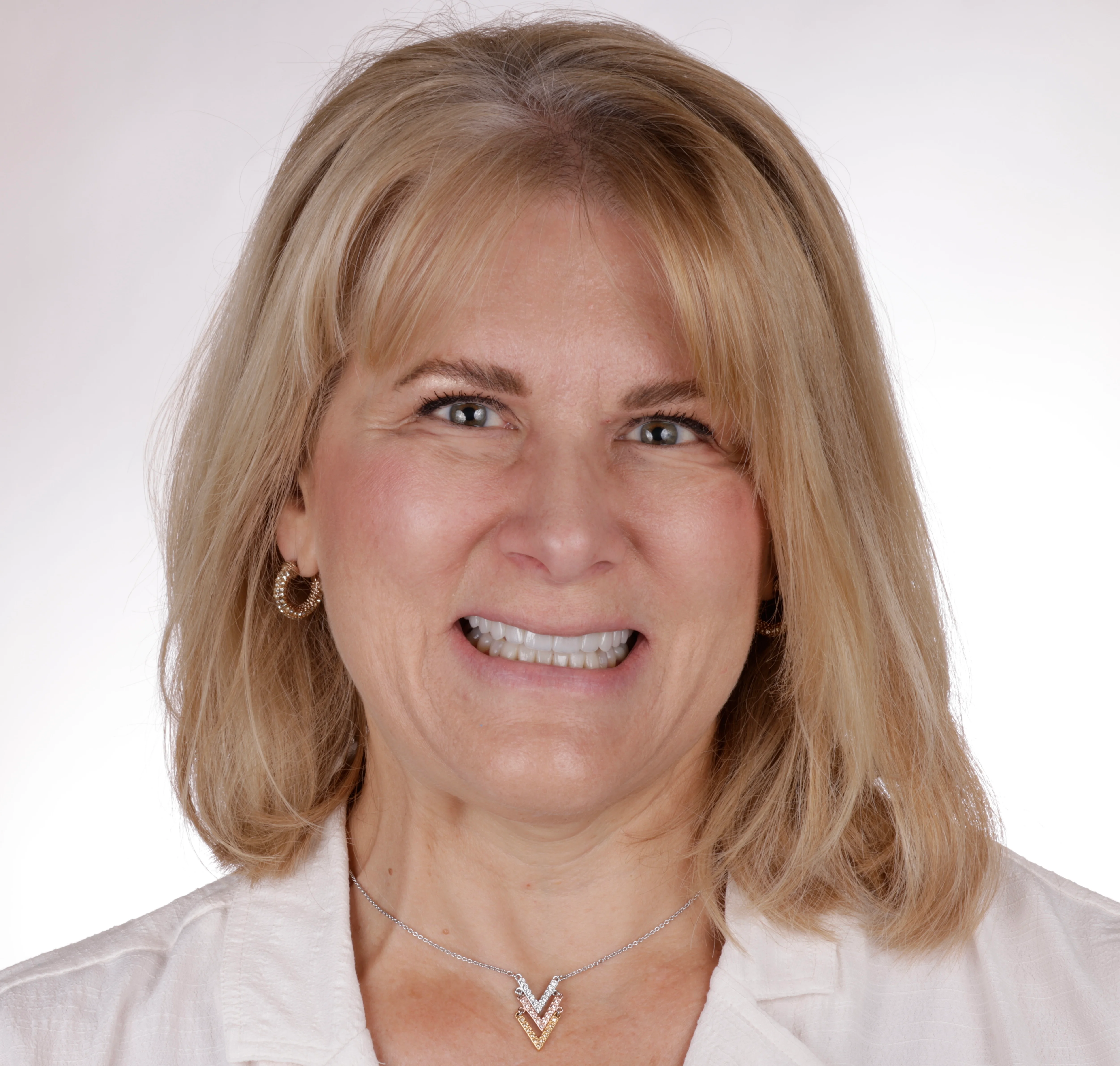 Full smile result after porcelain veneers and smile makeover by Dr Jared Ford in Fort Myers